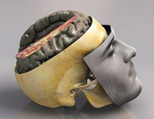 راهنمای تصویری آسیب به مغز و سر