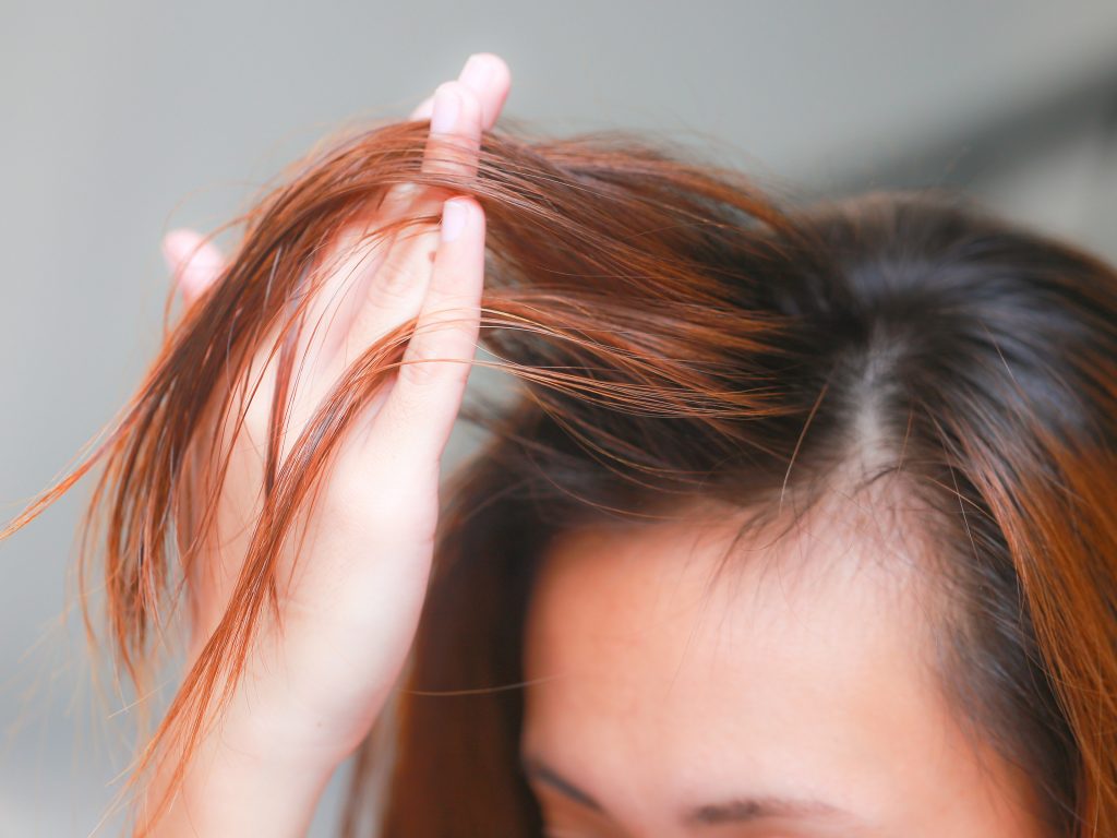 درمانهایی برای موهای کم پشت؛ آیا مفید هستند؟