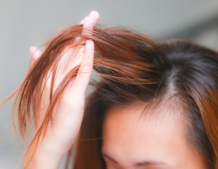 درمانهایی برای موهای کم پشت؛ آیا مفید هستند؟