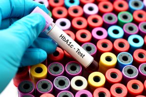 تست هموگلوبین A1C برای دیابت تست هموگلوبین A1C برای دیابت