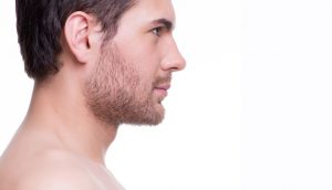 مراحل کاشت مو به روش BHT مراحل کاشت مو به روش BHT