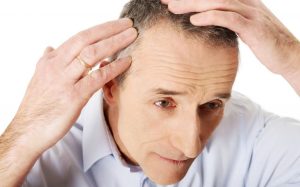 fut hair transplant reviews fut hair transplant reviews