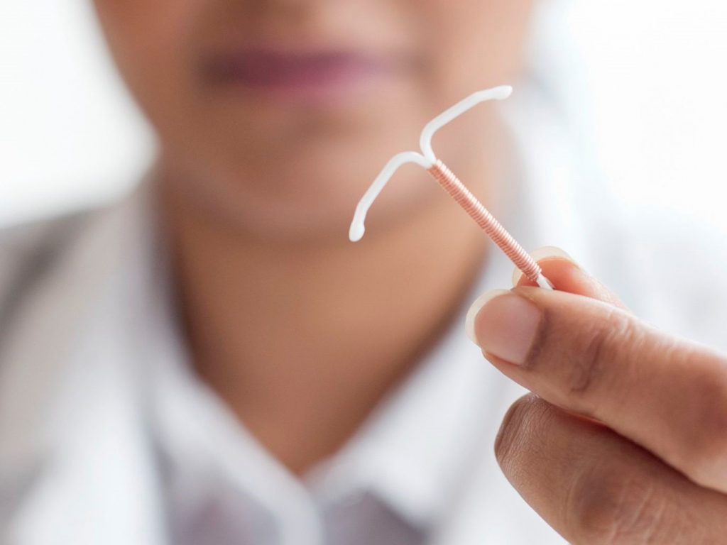 وسیله داخل رحمی ( IUD ) برای جلوگیری از بارداری