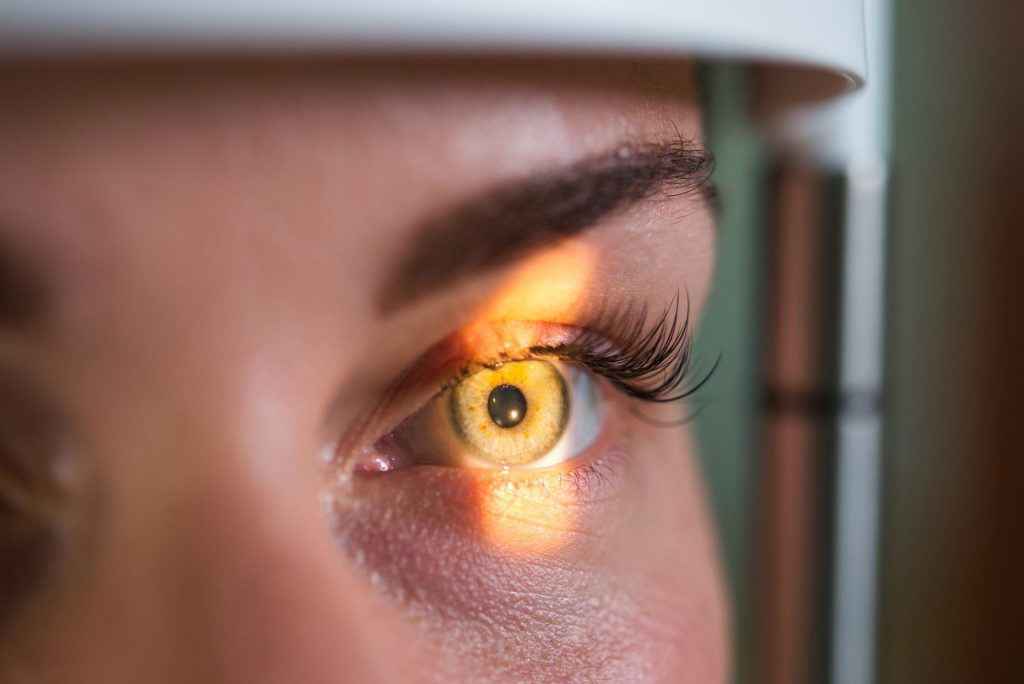 تشخیص و درمان ملانوم چشم