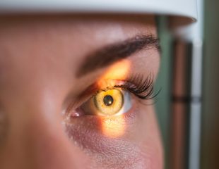 تشخیص و درمان ملانوم چشم