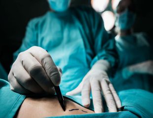 زخم های جراحی - بررسی 3 نوع رد برش پوست یا اسکار جراحی