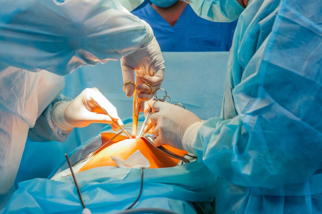 جراح عمومی کیست و قادر به درمان چه مشکلاتی است؟