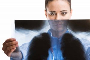 همه چیز درباره سرطان متاستاتیک به ریه همه چیز درباره سرطان متاستاتیک به ریه