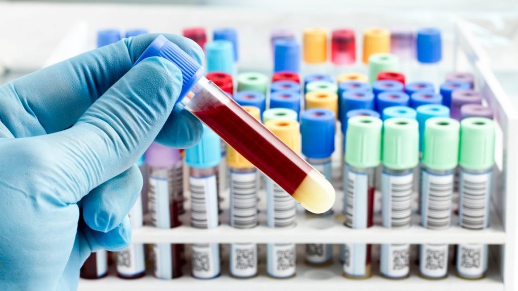 10 چیزی که پزشک شما درباره آزمایش خونتان به شما نمی‌گوید
