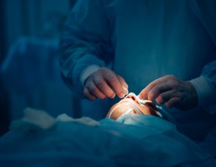 هزینه تمام شده عمل جراحی بینی چقدر است؟