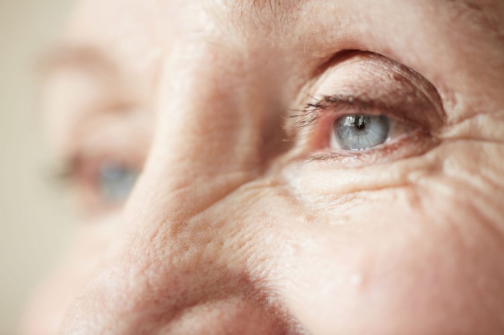 آرتریت و آرتروز چگونه روی چشم ها تاثیر می‌گذارند؟