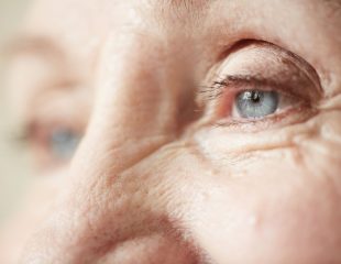 آرتریت و آرتروز چگونه روی چشم ها تاثیر می‌گذارند؟