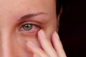 چه علل و بیماری هایی باعث قرمز شدن چشم می شوند؟ چه علل و بیماری هایی باعث قرمز شدن چشم می شوند؟