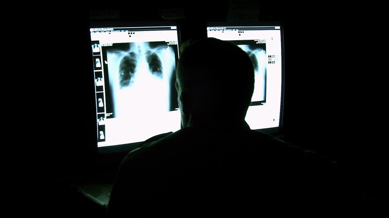 تشخیص کرونت با اشعه ایکس و سی تی اسکن