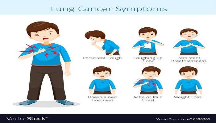 علایم سرطان ریه