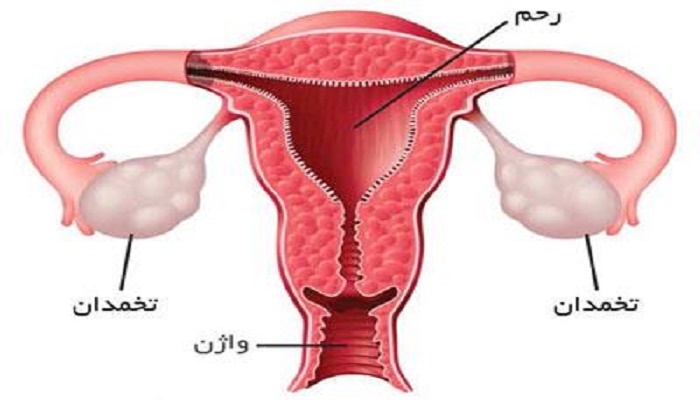 بررسی تخمدان